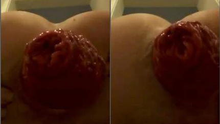 Fantastic Closeup Amateur Big Ass Girl Games With Her Monster Anal Prolapse - Large Insertions, Gaping [HD/Mp4/1000 MB]