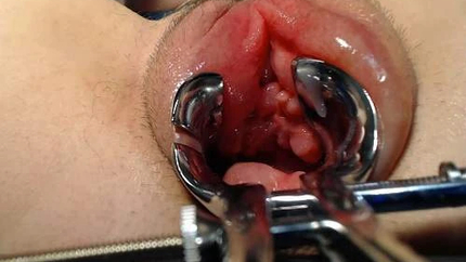 Queenofstretch Pumped Cunt And Tits, Urethra Play - Teen Fisting, Hairy Pussy [HD/Mp4/1000 MB]