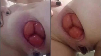 Beautiful pussy girl christinaasscore close-up show her unique anal prolapse - Anal Insertion, Closeup [HD/MPEG-4/88.6 MB]