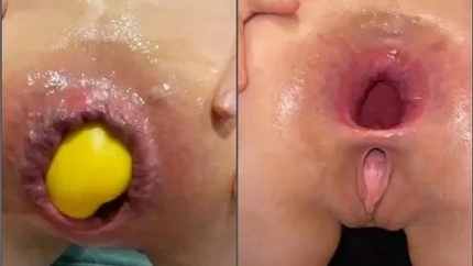 Kinky Wife M687pro Try Three Amigos Dildo Deep In Anal Prolapse - Fisting Sex, Webcam Fisting [FullHD/MPEG-4/14.0 MB]