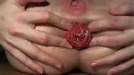 Webcam Brunette Very Close Shows Her Huge Anal Prolapse - Amateur, Gaping Anal [HD/Mp4/1000 MB]