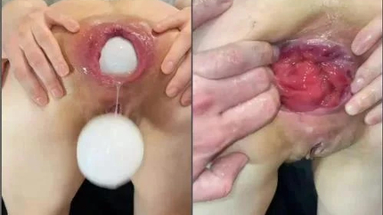 My Big Ass Wife M687pro Penetration Double Huge Balls Fully Anal - Pussy Fisting, Amateur Fisting [FullHD/MPEG-4/19.3 MB]