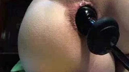 Unbelievable Webcam Rosebutt And Inflatable Dildo Anal - Anal Prolapse, Girl Gets Fisted [HD/Mp4/1000 MB]