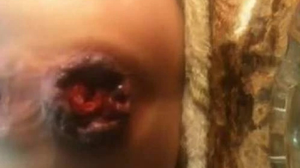 Super Amateur Mature With Giant Rosebutt Anal - Pussy Fisting, Amateur Fisting [HD/Mp4/1000 MB]