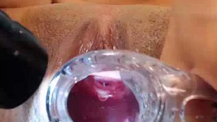 Speculum Gaping Ass And Pussy Closeup Webcam Brunette - Pussy Pump, Squirt [SD/MPEG-4/106 MB]