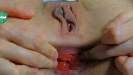 Young Teen With Large Labia And Wonderful Anal Prolapse - Anal Prolapse, Girl Gets Fisted [HD/Mp4/1000 MB]