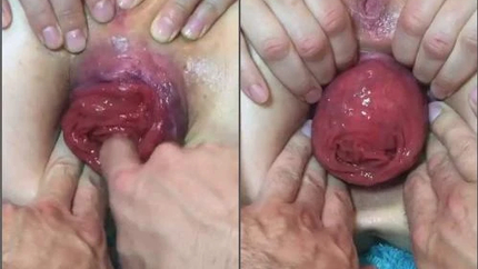 Tawney Mae Pov Show Her Giant Anal Prolapse Very Close-Up - Ball Penetration, Fisting Herself [HD/MPEG-4/59.8 MB]