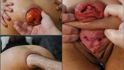 Vixenxmoon Hard Anal Destruction Fisting And Gaping - Premium User Request - Pump, Butplug [HD/Mp4/1000 MB]