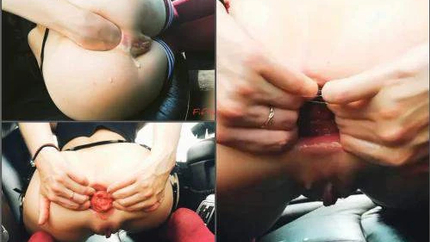 Fiftiweive69 Anal Fisting And Prolapse In The Car - Premium User Request - Mature, Teen Anal Gape [HD/Mp4/1000 MB]