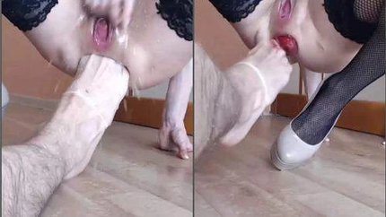 Russian Hairy Pornstar Natusamare Anal Prolapse Loose During Hard Footsex - Teen Fisting, Hairy Pussy [HD/Mp4/1000 MB]