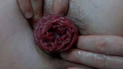 Analsexnasty Prolapse Loose After Rough Solo Fisting Porn - Anal Prolapse, Girl Gets Fisted [HD/Mp4/1000 MB]