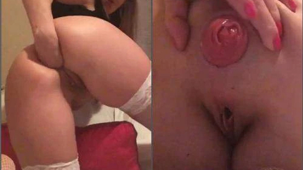 Wet Anal Prolapse Loose During Fisting And Dildo Xxx - Ball Penetration, Fisting Herself [HD/Mp4/1000 MB]