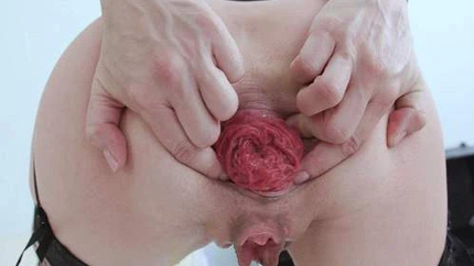 Sindy Rose Double Dragon Dildos And Gets Fisted In Monster Anal Prolapse - Prolapse, Stretching Gape [HD/Mp4/1000 MB]