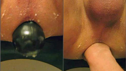 Crazy Wife Elbow Fisting And Dildo Domination To Husbands Asshole - Close Up, Anal [HD/Mp4/1000 MB]