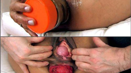 Anna An-411 Huge Insertion, Anal Fist, Cervix Fingering And Prolapse - Ball Penetration, Fisting Herself [HD/Mp4/1000 MB]
