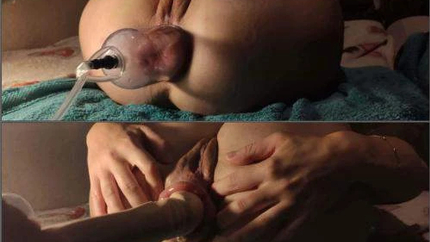 Cometodaddyg Her Destructed Ass Full Video - Premium User Request - Anal Prolapse, Girl Gets Fisted [HD/Mp4/1000 MB]