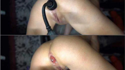 Teen Penetration Alien And Huge Hulk Rubber Dildos In Rosebutt Anus - Bottle Penetration, Fisting Dildo [HD/Mp4/1000 MB]