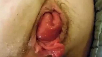 Bbw Anal Slave Awesome Anal Rosebutt Stretched With Big Ball And Fisting Sex - Lesbian, Pussy Stretching [HD/Mp4/1000 MB]