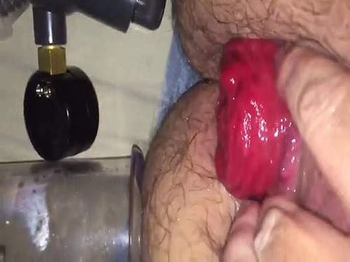 Monster Size Anal Prolapse After Ass Pumping - Anal Insertion, Closeup [HD/Mp4/1000 MB]