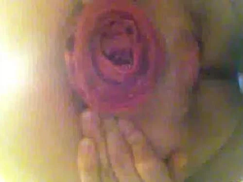 Kinky Webcam Girl Closeup Giant Prolapse Anal Play - Close Up, Anal [HD/Mp4/1000 MB]