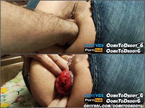 Cometodaddy G Tore My Jeans With My Ass Gape, Prolapse Anal Amateur - Rimming, Stockings [HD/Mp4/1000 MB]
