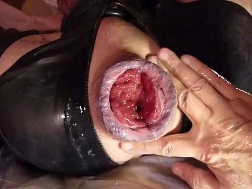 Gays Extremely Anal Prolapse Porn During Fisting Sex Homemade Pov - Prolapse Porn, Rosebutt [HD/Mp4/1000 MB]