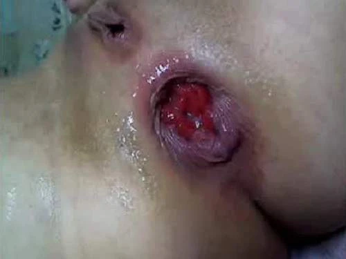 Very Close Sweet Rosebutt Anal Webcam Hairy Girl - Dap, Big Ass [HD/Mp4/1000 MB]
