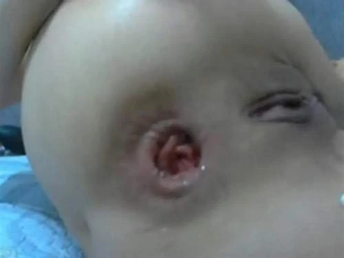 22 Years Old Asian Bitch Rosebutt Asshole Closeup - Rosebutt, Anal Fingering [HD/Mp4/1000 MB]