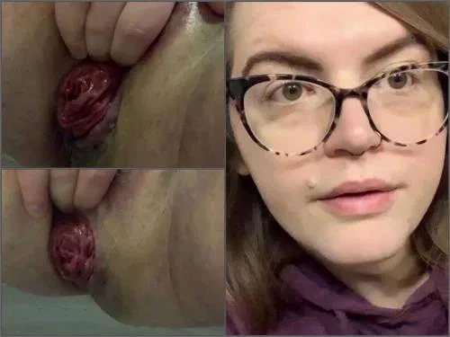 Worthlessholes Public Rosebud And Peehole Fucking - Premium User Request - Anal Prolapse, Girl Gets Fisted [SD/MPEG-4/281 MB]