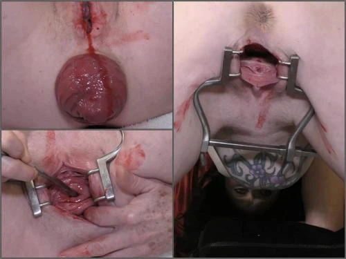 Bloody Period Speculum Examination With Dirty Brunette - Booty Girl, Solo Fisting [FullHD/MPEG-4/395 MB]