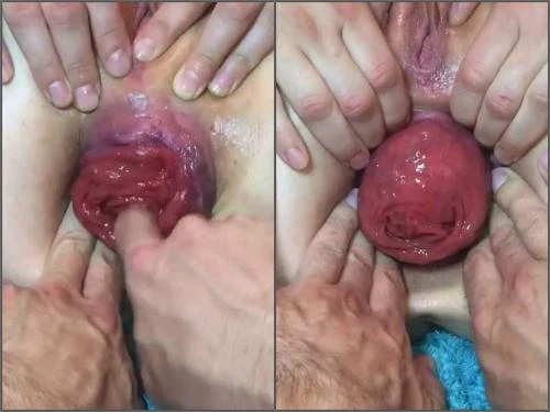 Tawney Mae Pov Show Her Giant Anal Prolapse Very Close-Up - Ball Penetration, Fisting Herself [HD/MPEG-4/59.8 MB]