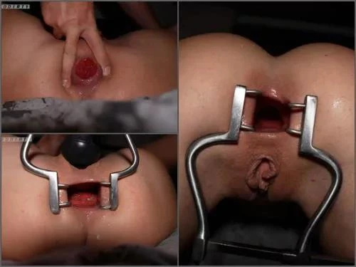 DesignedDirty Open wide! Ass destroyed with big anal toys POV amateur - Anal Prolapse, Girl Gets Fisted [FullHD/MPEG-4/211 MB]