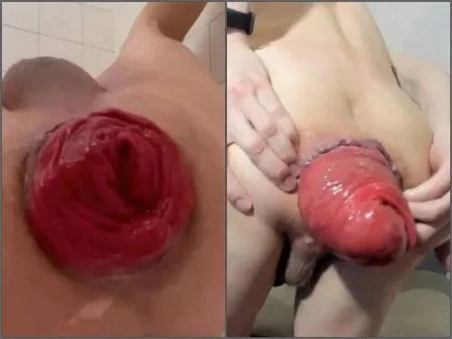 Awesome male shocking anal prolapse stretching comilation - Amateur, Gaping Anal [FullHD/MPEG-4/765 MB]